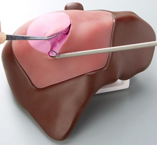 Liver model for ultrasonic scalpel incision practice