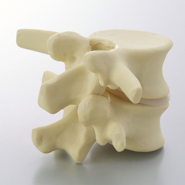 Corpus vertebrae