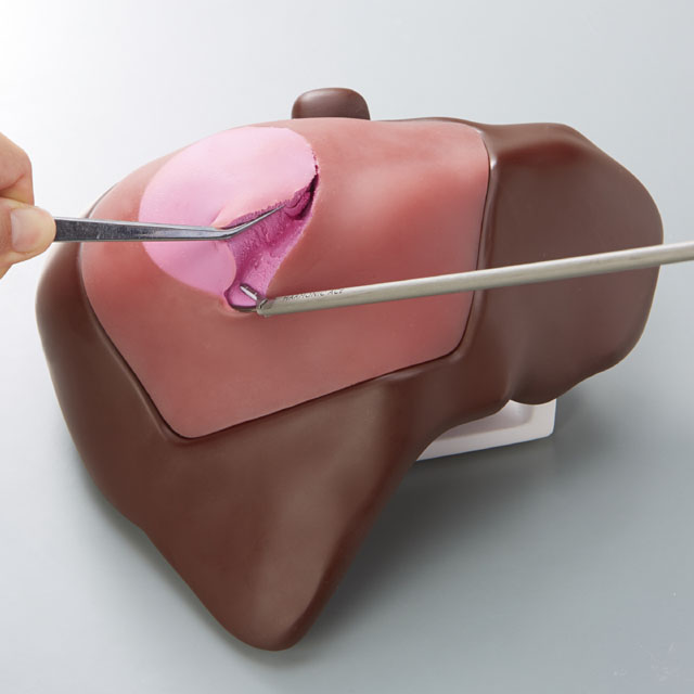Model for partial liver resection