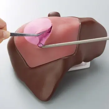 Model for partial liver resection